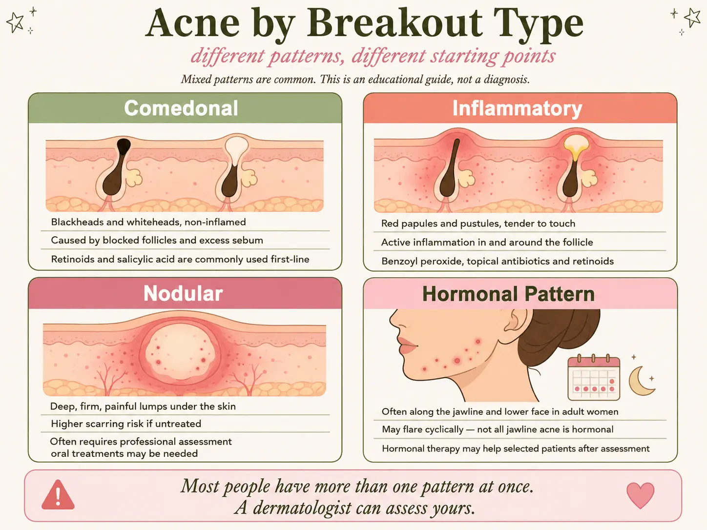 Infographic matching comedonal, inflammatory, deep nodular and hormonal acne patterns with their usual treatment approach
